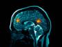 شناسایی سن دقیق انسان با اسکن مغزی ممکن شد