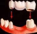 برای قبولی در رشته پروتزهای دندانی چه ترازی لازم است؟