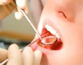 برای قبولی در رشته دندان پزشکی چه ترازی لازم است؟ سایرشهرها