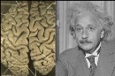 مهمترین تفاوت مغز انیشتین با سایر انسانها کشف شد