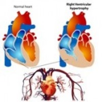 ارایه آخرین یافته های درمانی در پنجمین همایش قلب و فناوری