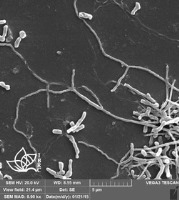 شناسایی یک جنس جدید باکتری رشته‌یی