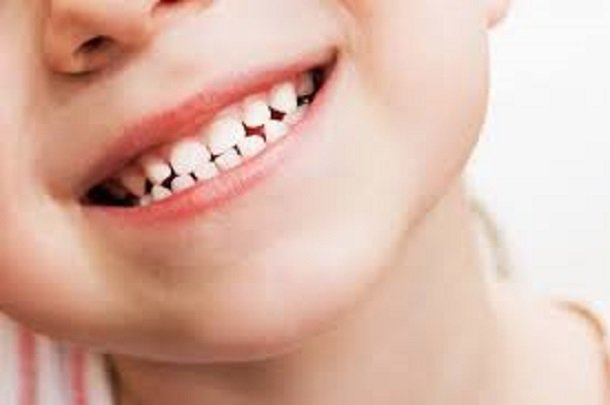 نکاتی که والدین باید در مورد دندان‌های شیری کودکان بدانند