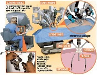 جراحی تومورهای ریه با روبات چهار بازو