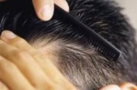ابداع درمان‌های ریزش مو با سلول‌های بنیادی