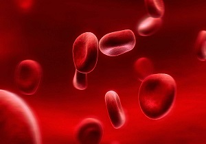 نشانه‌ها و انواع شایع کم خونی + راهکار‌های درمانی