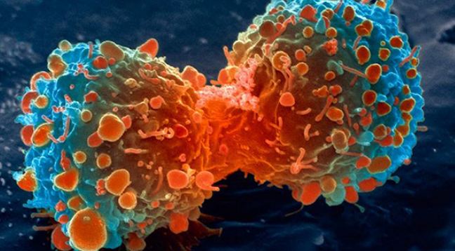 ویروسی که قاتل سلول‌های سرطانی می‌شود