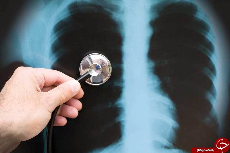 چه کسانی در معرض خطر ابتلا به نارسایی تنفسی هستند؟