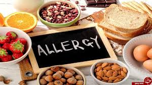 آیا شما هم آلرژی غذایی دارید؟