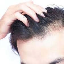 آیا مکمل بیوتین واقعا از ریزش مو جلوگیری می‌کند؟
