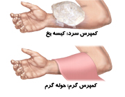 خونمردگي و کبودي پوست